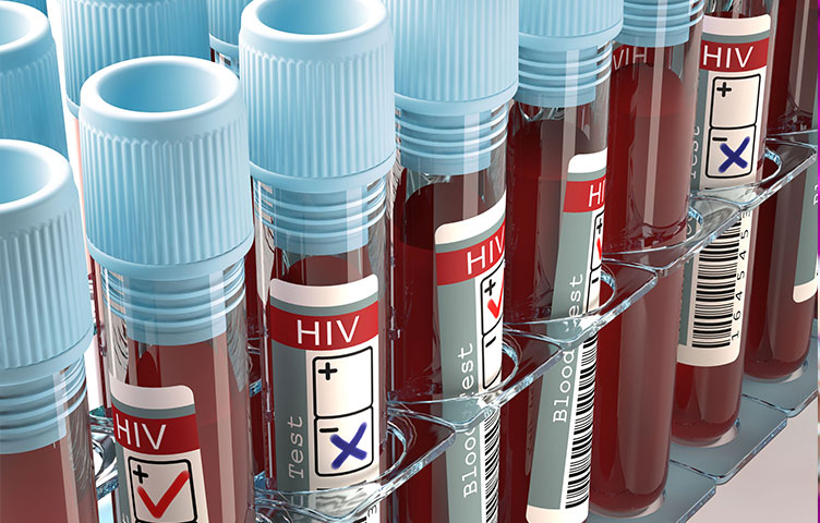 HIV & AIDS